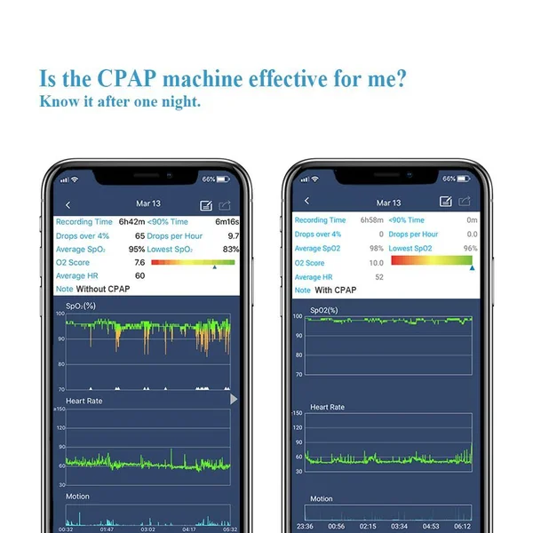 Wellue SleepU Continuous Wrist Oxygen Monitor with Alarm. Sleep Oximetry Report. Track Sleep Apnea Treatments at Home. Free APPu